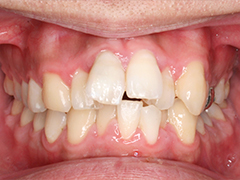 できるだけ目立たない装置を使用