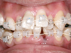 できるだけ目立たない装置を使用