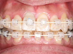 できるだけ目立たない装置を使用